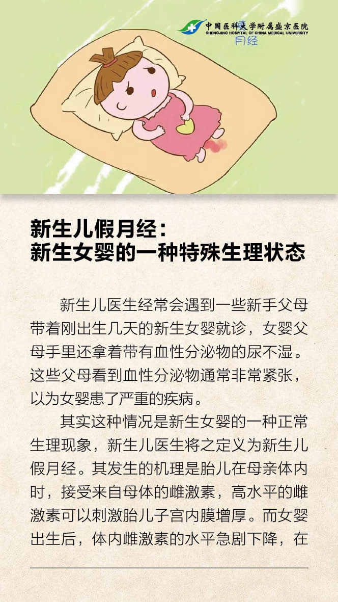 新生儿假月经1.jpg